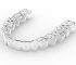 64066d7bbe555a88b6814b56_Forest20Lake20Invisalign20